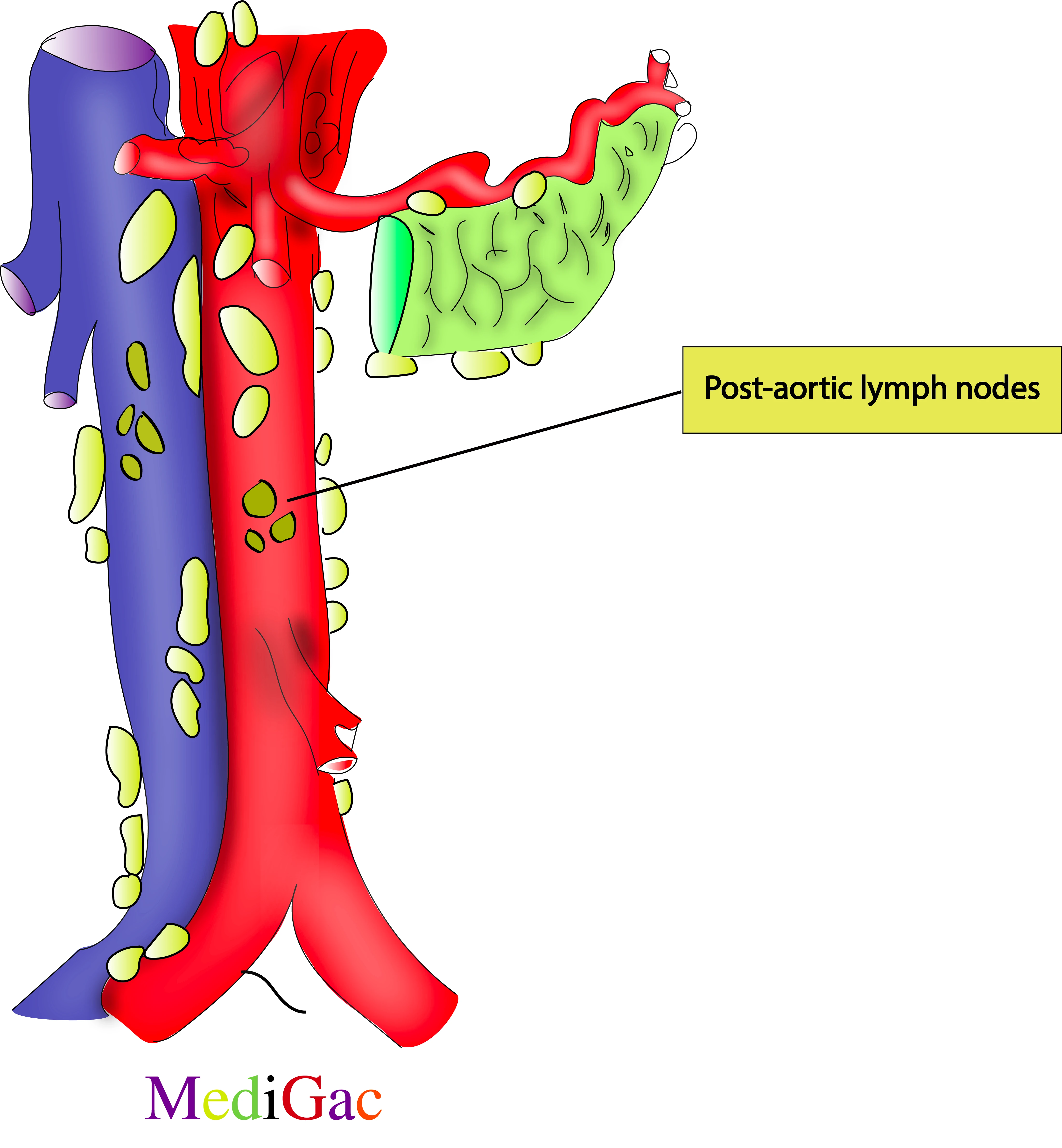 Post aortic lymph nodes